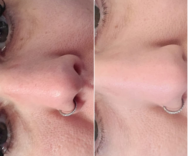 antes-x-depois-16.jpg