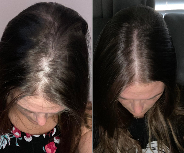 antes-x-depois-21.jpg