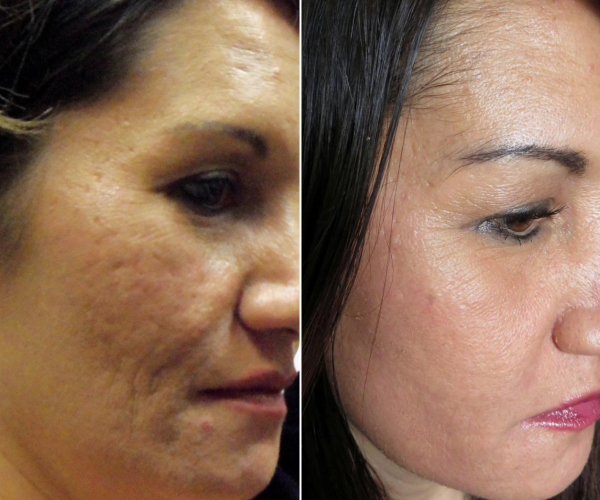 antes-x-depois-4.jpg