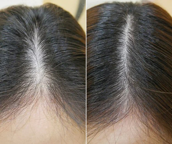 antes-x-depois-8.jpg